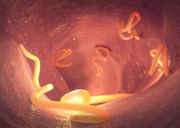 Kemenkes Klaim Penurunan Kasus Cacingan dan Peringatan Infeksi Berulang