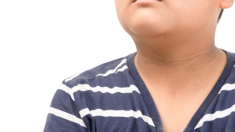 Periksa Tanda Tanda Diabetes yang Muncul pada Kulit Anda