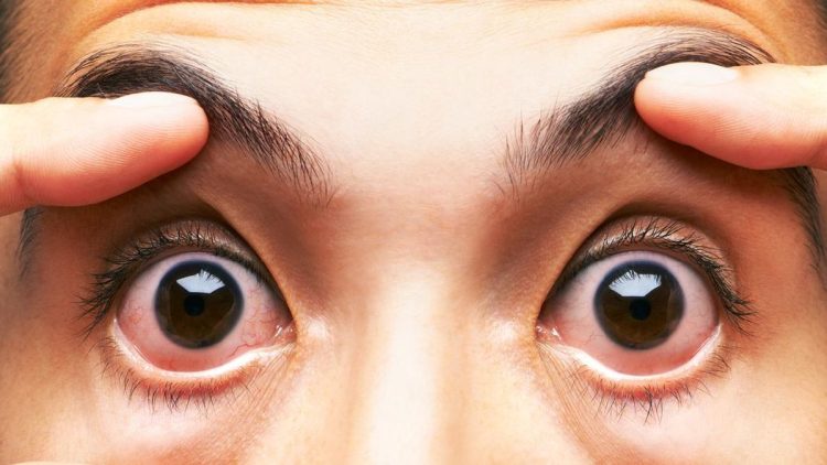 Kentut Bikin Mata Merah, Apakah Itu Benar?