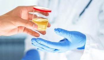 Ciri-ciri Penyakit Ginjal Melalui Air Kencing yang Perlu Diketahui