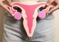 Viral Rahim Copot di Media Sosial, Ini Penjelasan dari Perkumpulan Dokter Kandungan