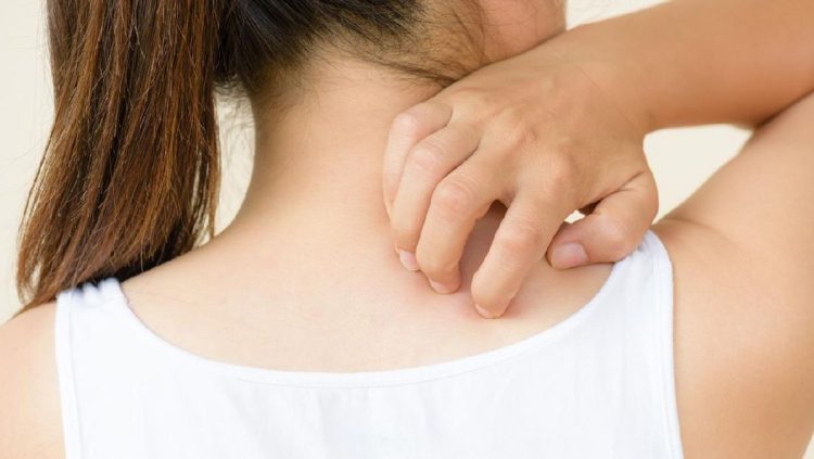 5 Gejala Penyakit Ginjal di Kulit, Kenali Sebelum Semakin Parah