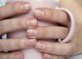 Garis Putih pada Kuku dan Penyebabnya yang Perlu Diketahui