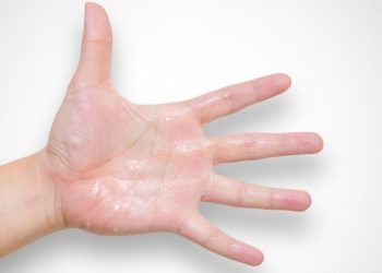 7 Cara Efektif Mengatasi Tangan Panas Akibat Cabai