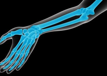 Dampak Minuman Manis terhadap Kesehatan Tulang yang Sering Diabaikan